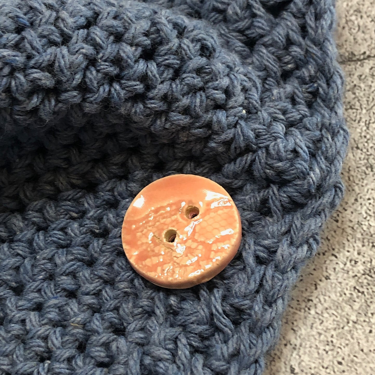 Round Pink Lace Buttons